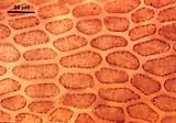 3 - Cellule corticali in visione  superficiale